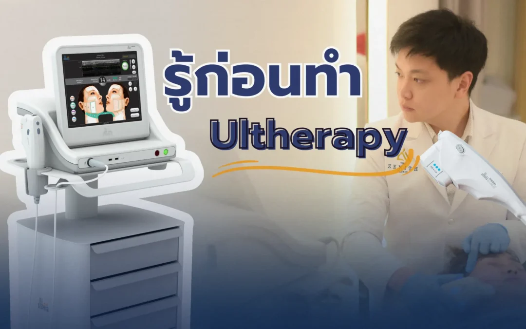 Ultherapy (อัลเทอร่า) คืออะไร? ทำที่ไหนดี ?